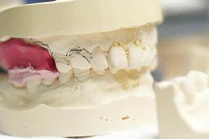 副腎疾患の専門治療が受けられる東京のクリニックガイド